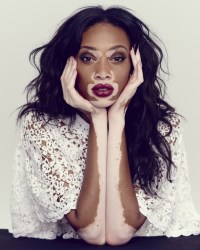 winnie-harlow-the-observer-photos1