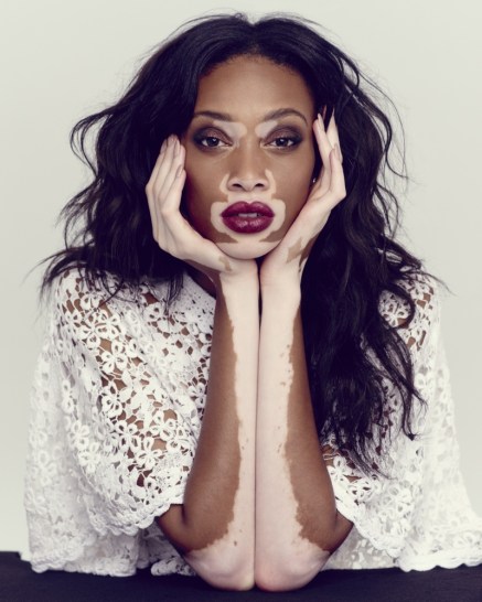 winnie-harlow-the-observer-photos1